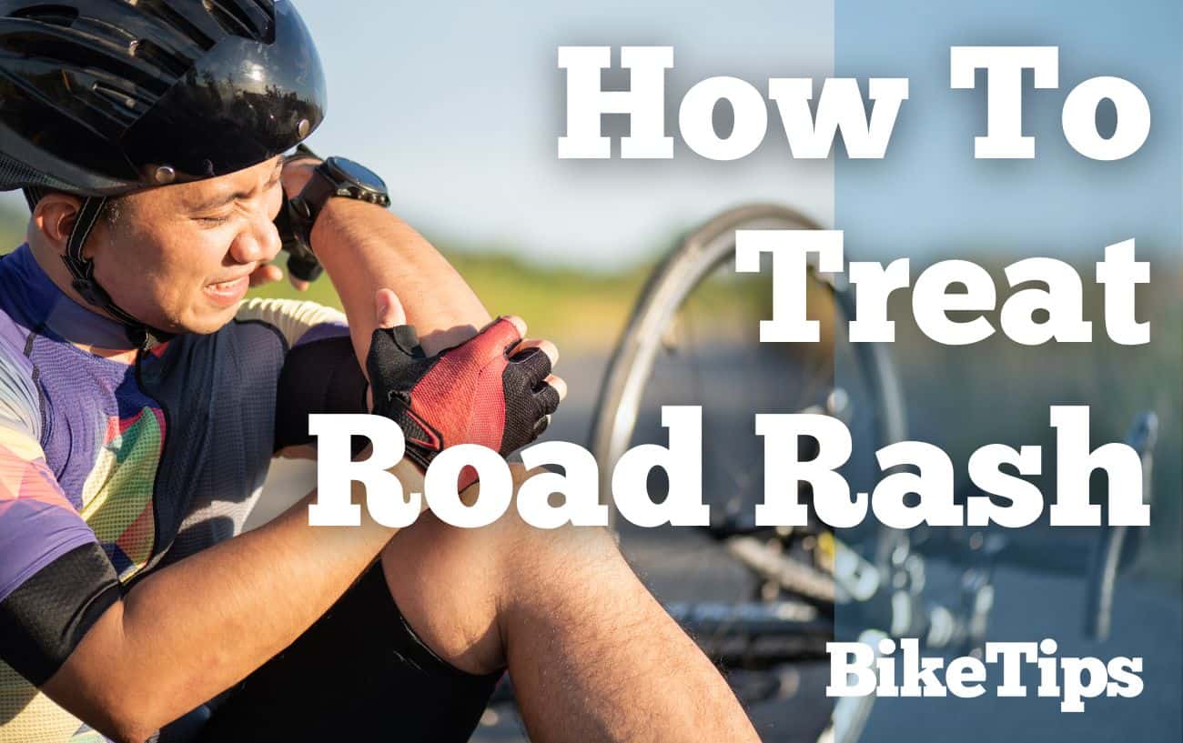 How To Treat Road Rash: Title Image