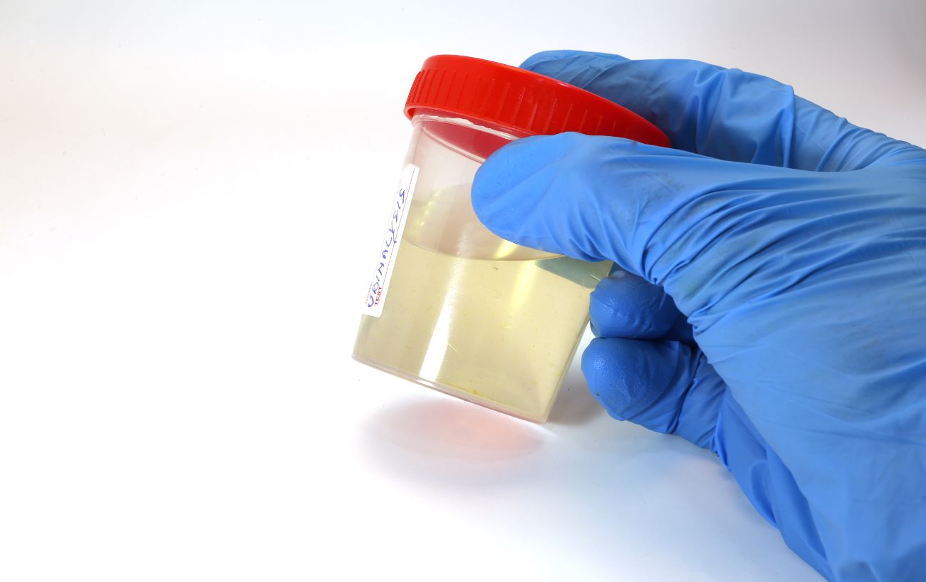 A sample collected for anti-doping protocols.